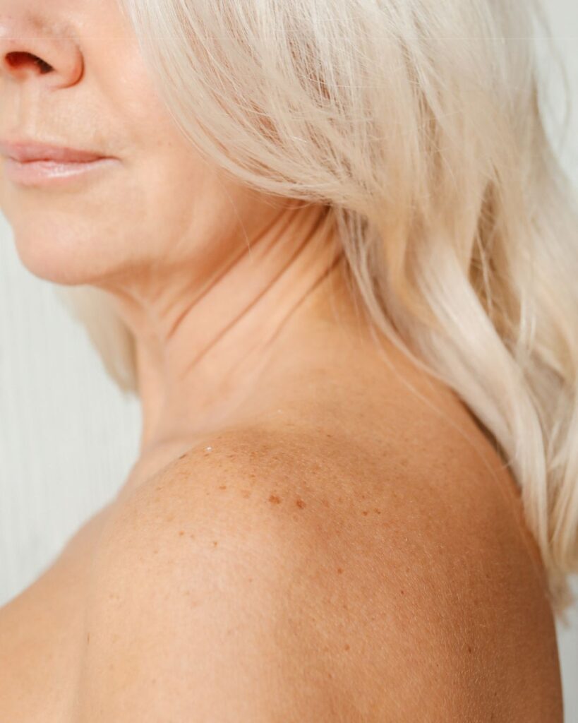 Close-up of a midlife woman's face and skin, highlighting natural texture and hormonal skin changes.