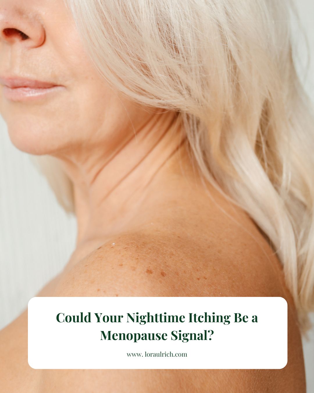 Close-up of a midlife woman's face and skin, highlighting natural texture and hormonal skin changes.