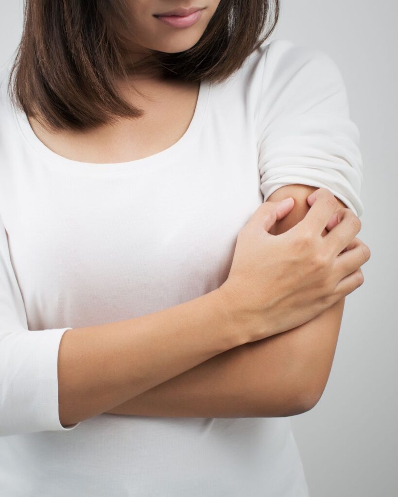 Woman with irritated upper arm showing a common symptom of perimenopause itchy skin.