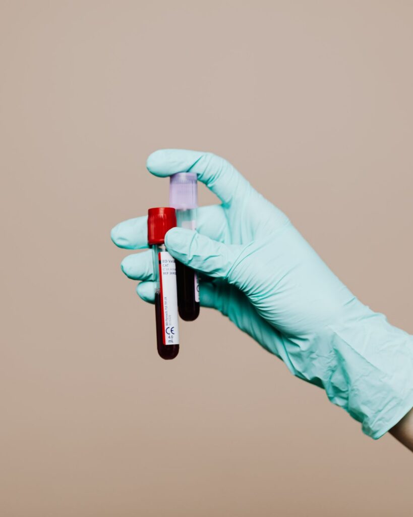 A healthcare professional wearing mint gloves holding two blood vial collection tubes for menopause lab tests.
